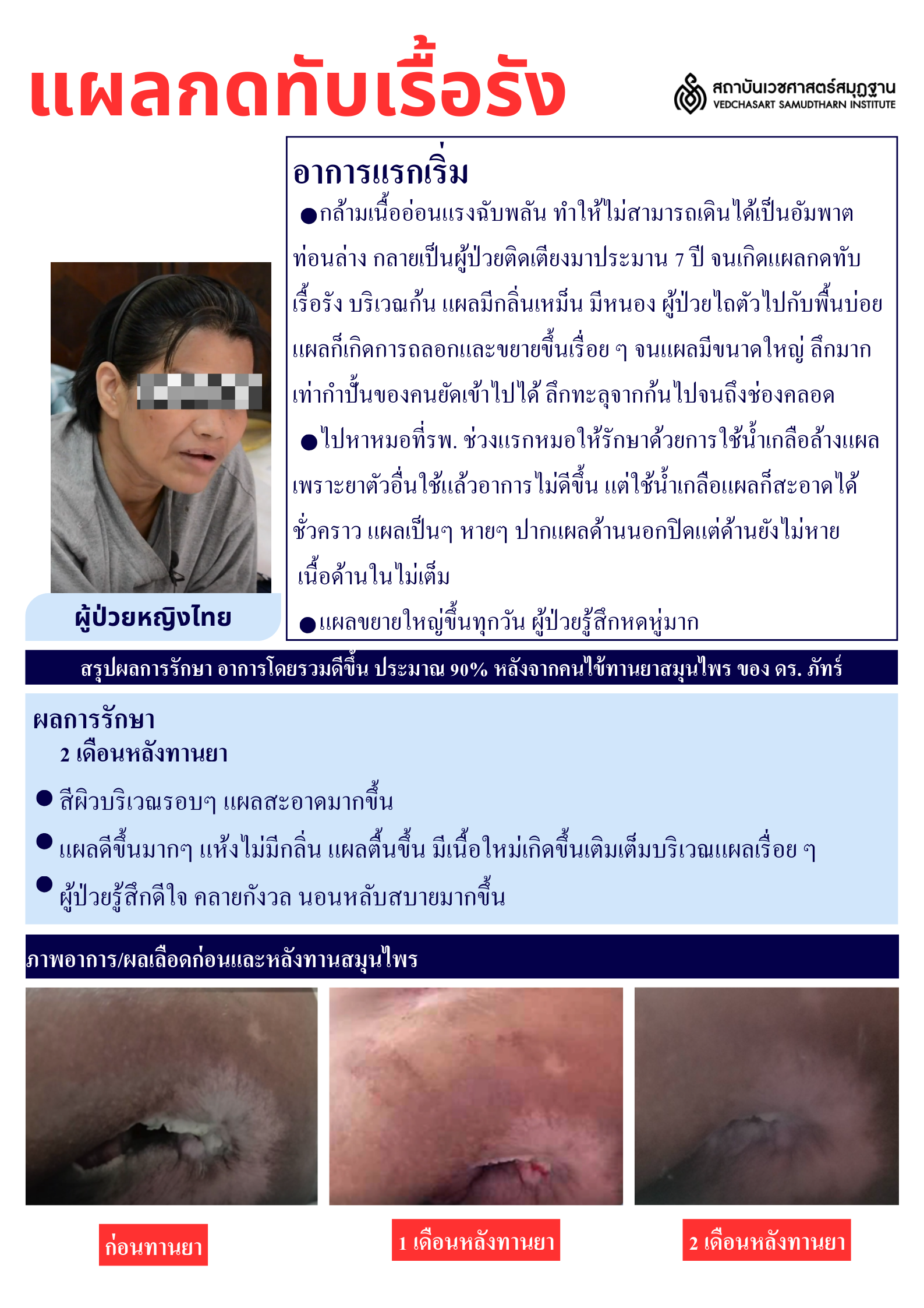 แผลอักเสบ