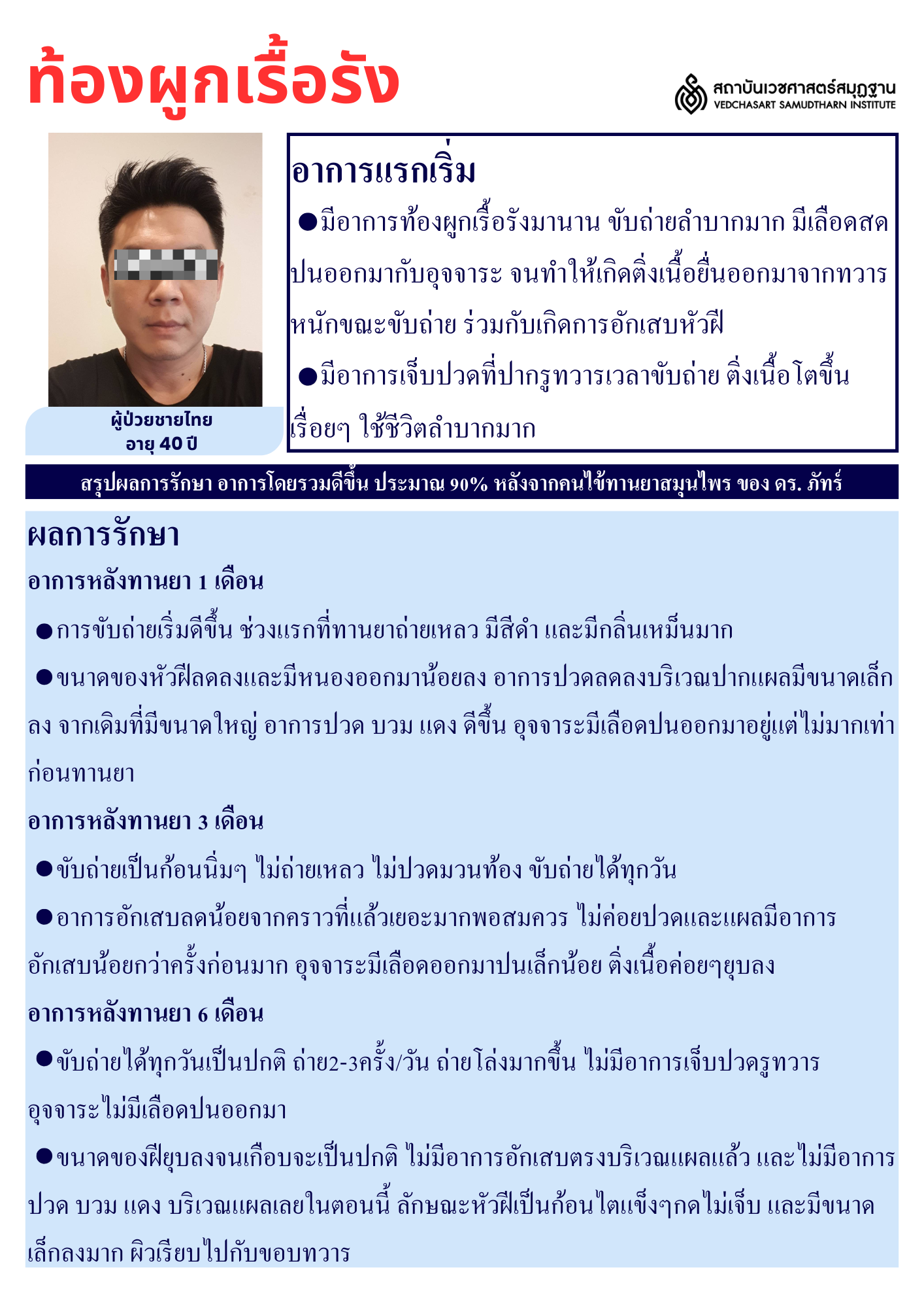 ระบบขับถ่าย