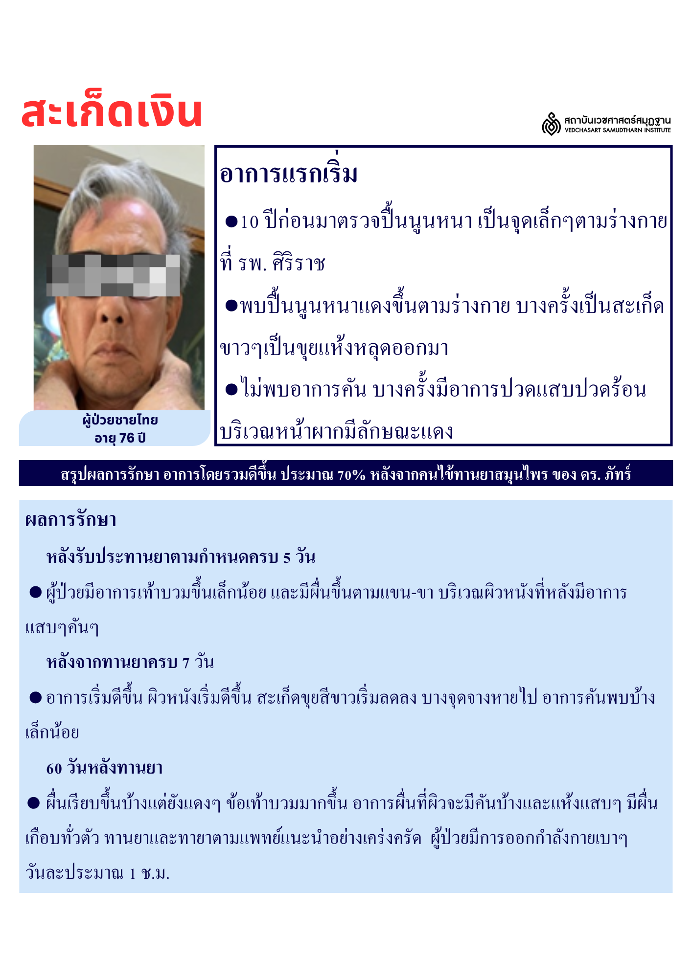 โรคผิวหนัง