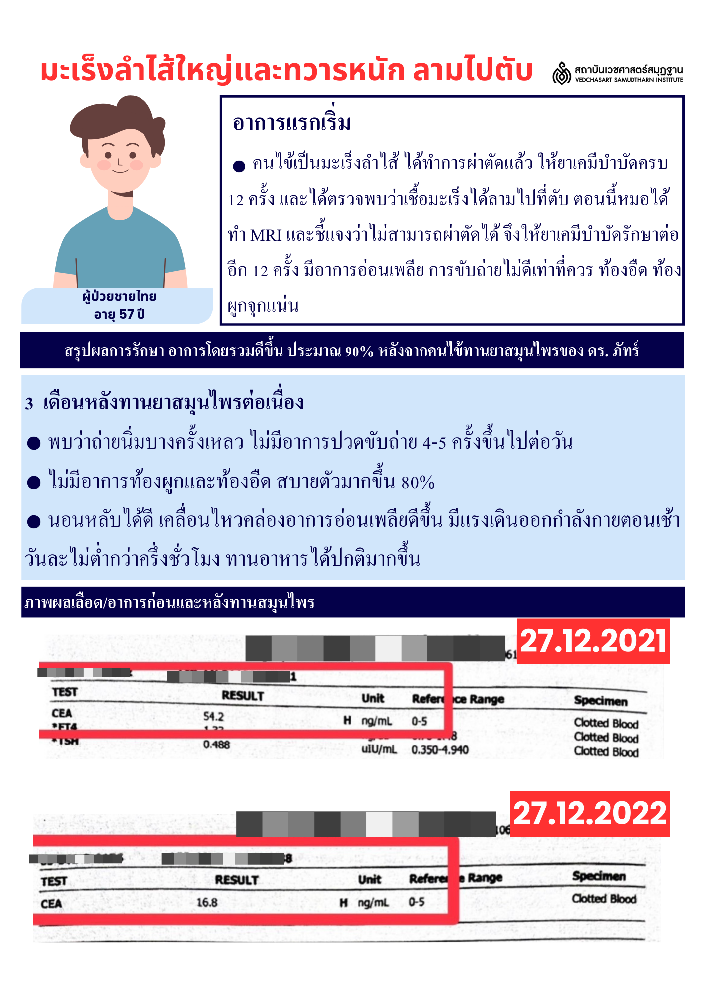 มะเร็งลำไส้